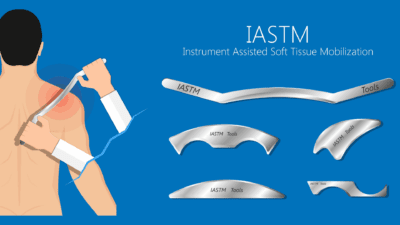 IASTM Treatment in Jaipur 