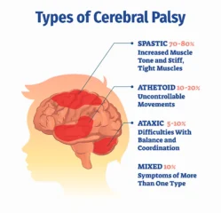 Cerebral Palsy Treatment in Jaipur