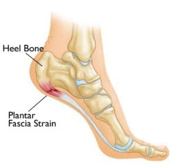 Heel Pain Treatment in Jaipur