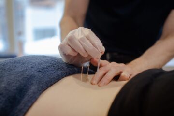 Dry Needling Treatment in Jaipur 