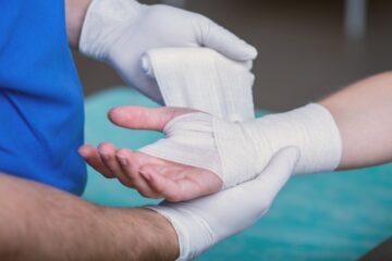 Rehabilitation of Hand Burn Injuries Treatment in Jaipur 