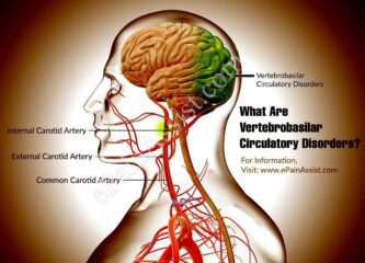 Vertebrobasilar insufficiency (VBI) Treatment in Jaipur